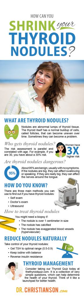 how-can-you-shrink-thyroid-nodules